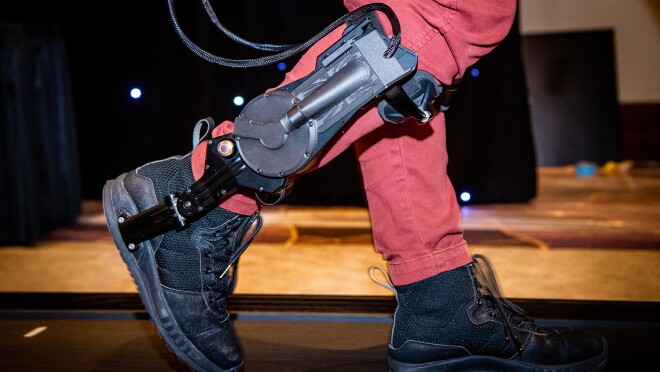 A close up image of legs walking on a treadmill with a device on the right leg.