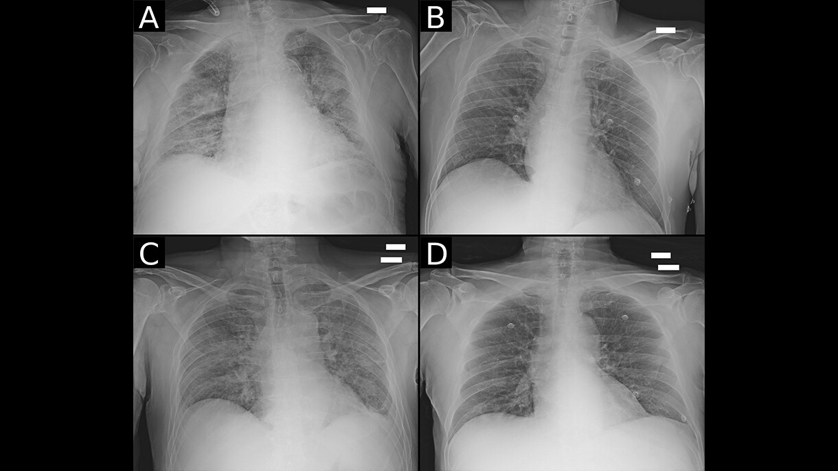 Diagnostic imagery of a lung, illustrating work as part of AWS Diagnostic Data Initiative