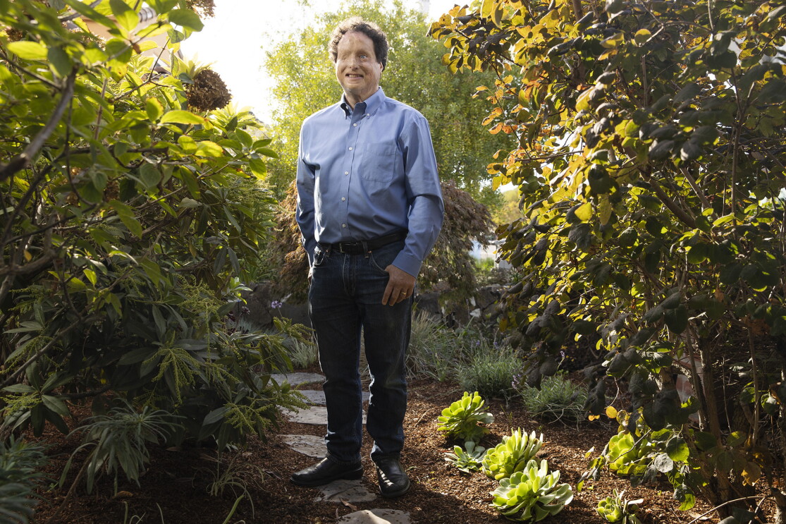 Josh Miele, Principle Accessibility Researcher at Amazon Lab126, stands for a portrait in a garden outside his home.