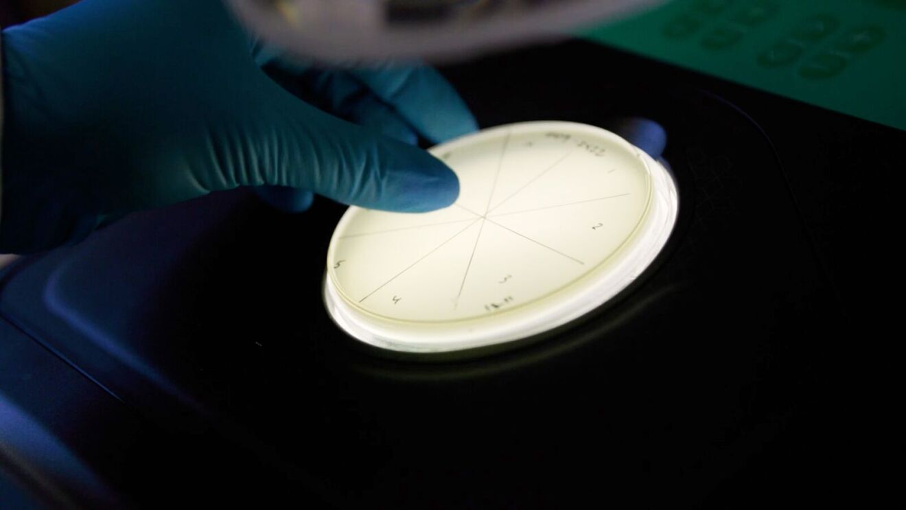 Gloved hand pointing at petri dish with bacterial cultures