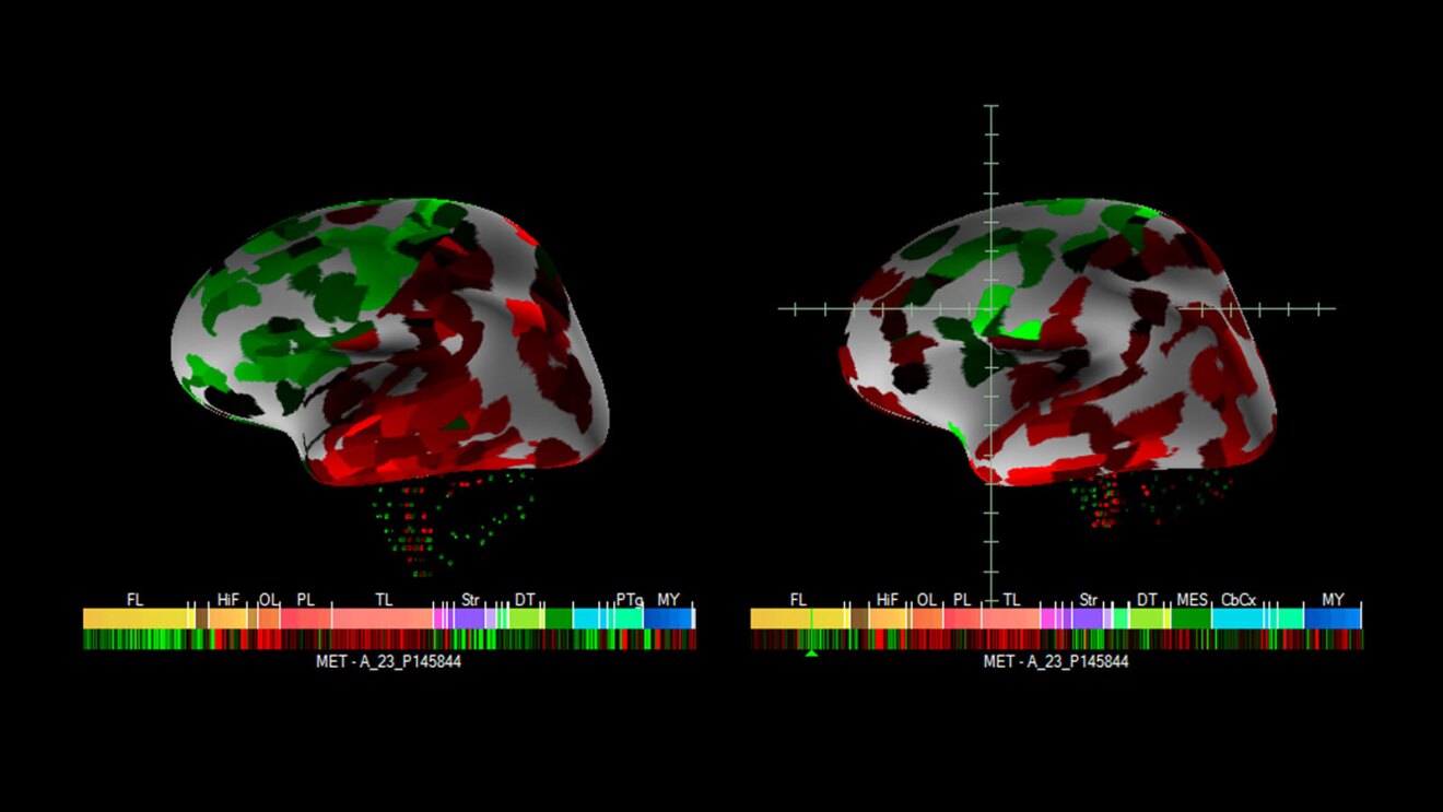 A photo of mapping from a brain scan.