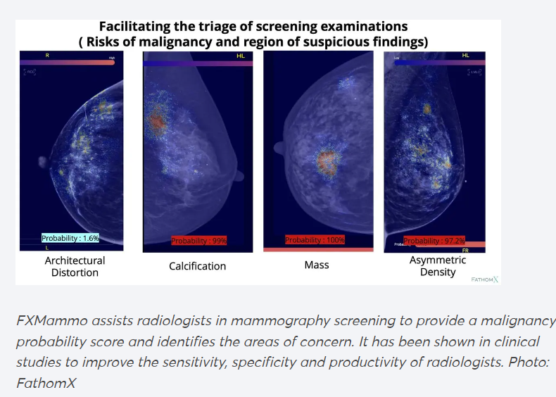 breast cancer.png 