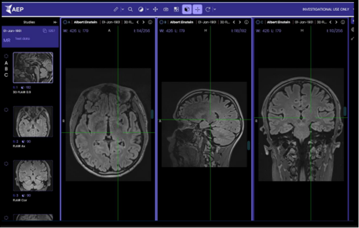 A display of a structural MRI of the brain, accessible through the AEP Clinician Portal